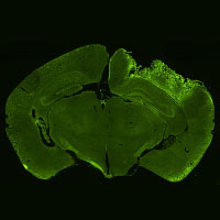 Autophagy brain imaging